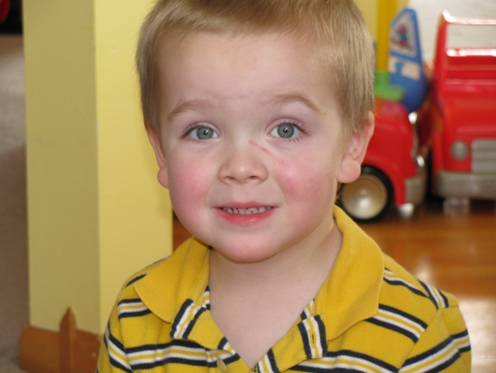 Hayden Face Scratch