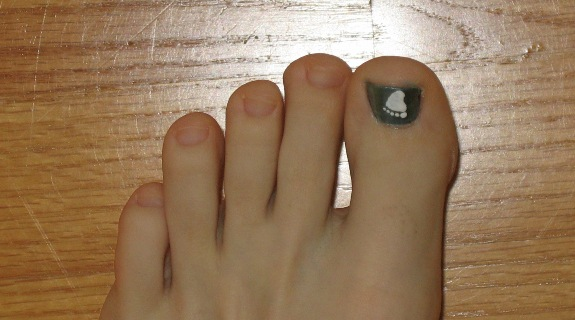 Toe Toe